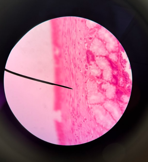 <p>INVOLUNTARY MUSCLE</p><ul><li><p>Thick layer on edge of skin</p></li><li><p>Looks similar to cardiac muscle in formatting</p></li><li><p>Has squiggly lines of purplish color</p></li></ul><p></p>