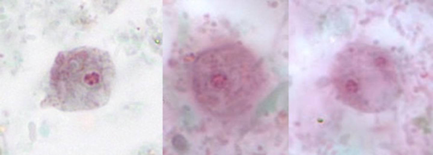 <p>2 nuclei, fragmented karyosome</p>