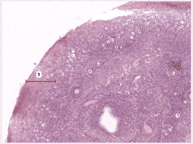 <p>Identify the structure labeled as 1.</p>