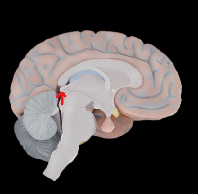 term image