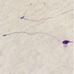 <p>Identify the sperm morphology.</p>