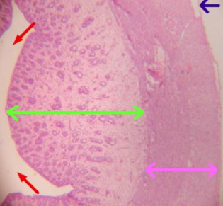 <ul><li><p><strong>Endometrio:</strong> Mucosa</p></li><li><p><strong>Miometrio:</strong> Muscular</p></li><li><p><strong>Perimetrio:</strong> Serosa (posterior) y adventicia (anterior)</p></li></ul><p></p><p>El endometrio y miometrio sufren cambios durante el ciclo menstrual.</p>