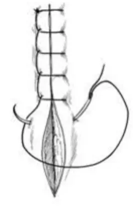 <p>Identify this suture pattern.</p>