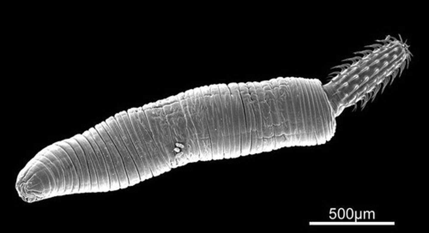 <p>Spiny-head worms.</p>