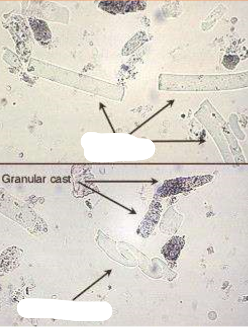 <p>What type of cast are the arrows pointing to?</p>