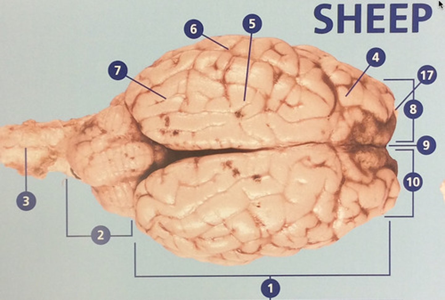 <p>Large, deeply wrinkled region of the brain responsible for conscious experience including perception, emotion, thought, and planning (#1)</p>