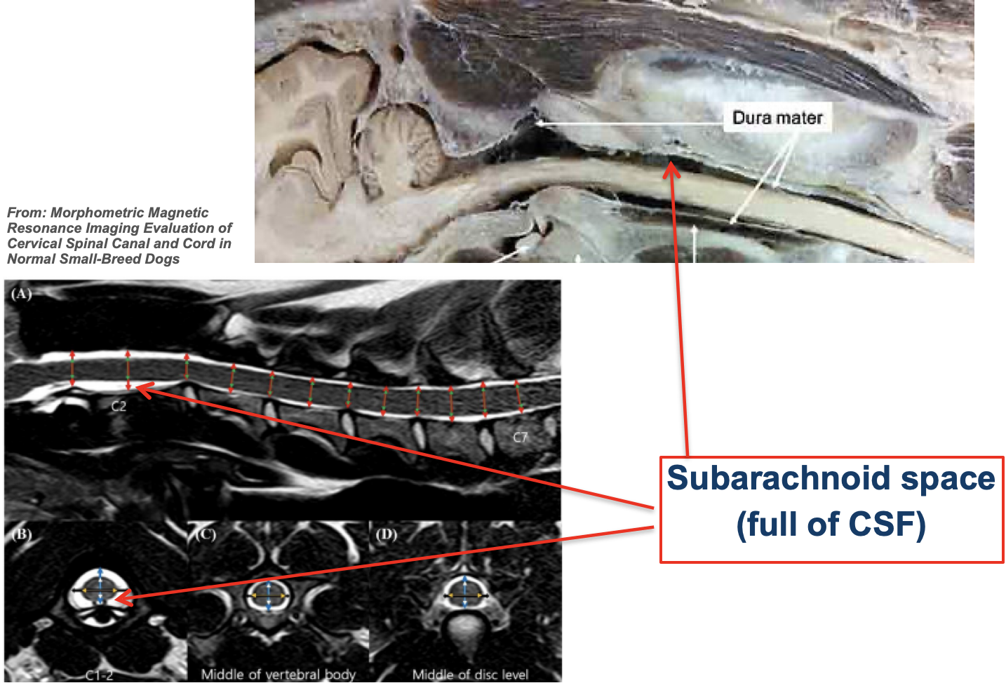<p>Delicate collagenous connective tissue</p><ul><li><p>In close contact with the dura mater because the pressure of the <strong>cerebrospinal fluid (CSF)</strong>, that occupies the<strong> subarachnoid space,</strong> pushes the arachnoid outwards.</p></li><li><p>Numerous fine filaments which blend with pia mater - spider’s web appearance</p></li></ul><p></p>