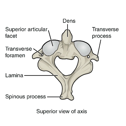 <p>Dens is raised and articulates with C1</p>