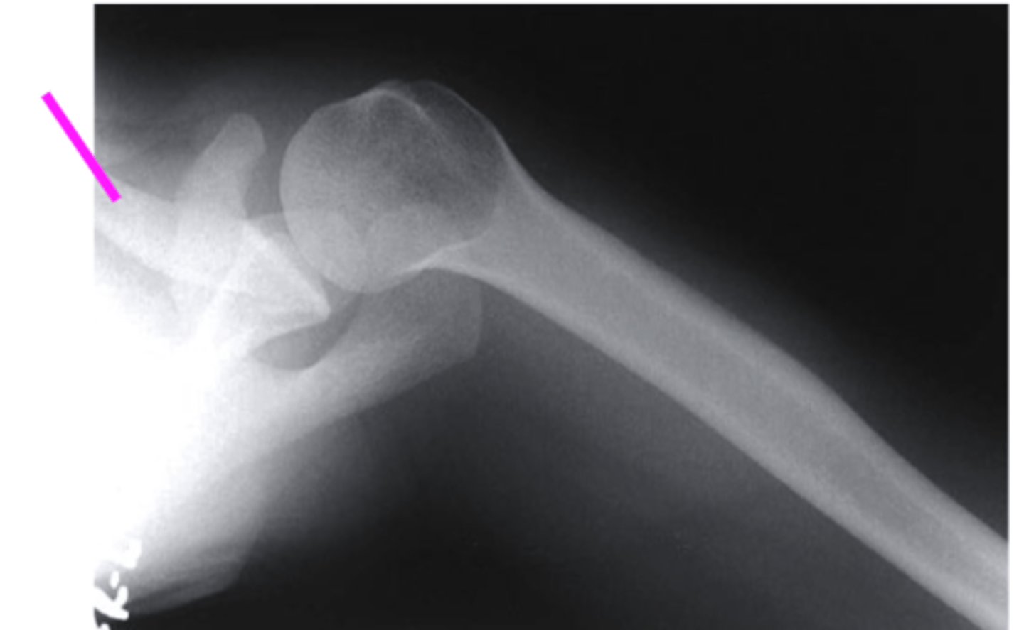 <p>what does the pink line point to?</p>