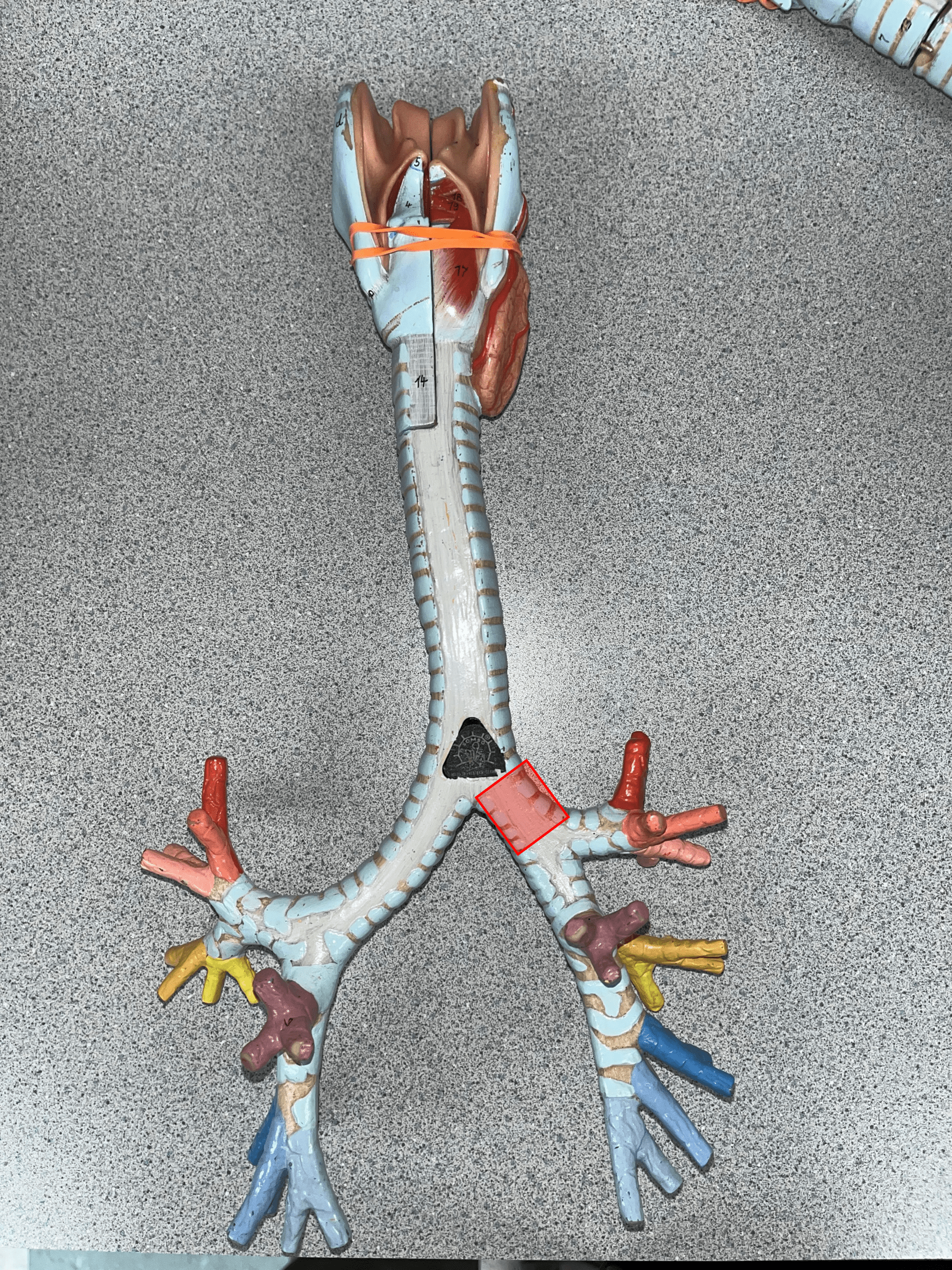 • The L. branch of the bronchial tree after the carina.

• Supplies the L. lung.

• Branches into two secondary bronchi.

• Also known as a main bronchus.