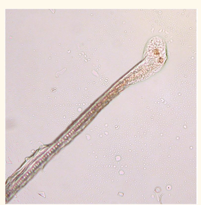 <p>Which growth stage is this hair in?</p>