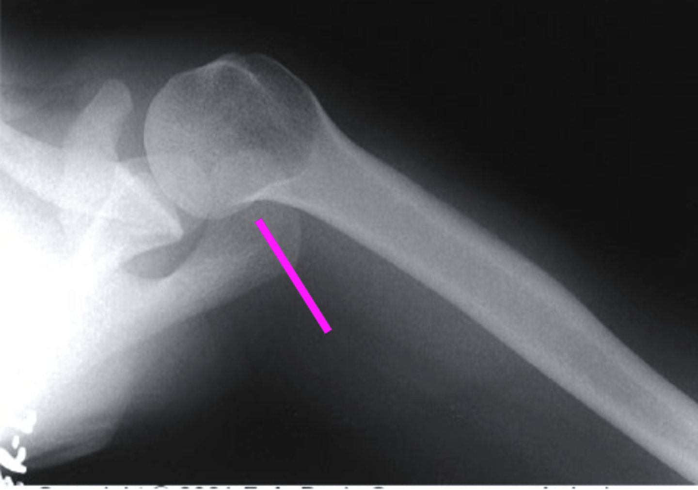 <p>what does the pink line point to?</p>