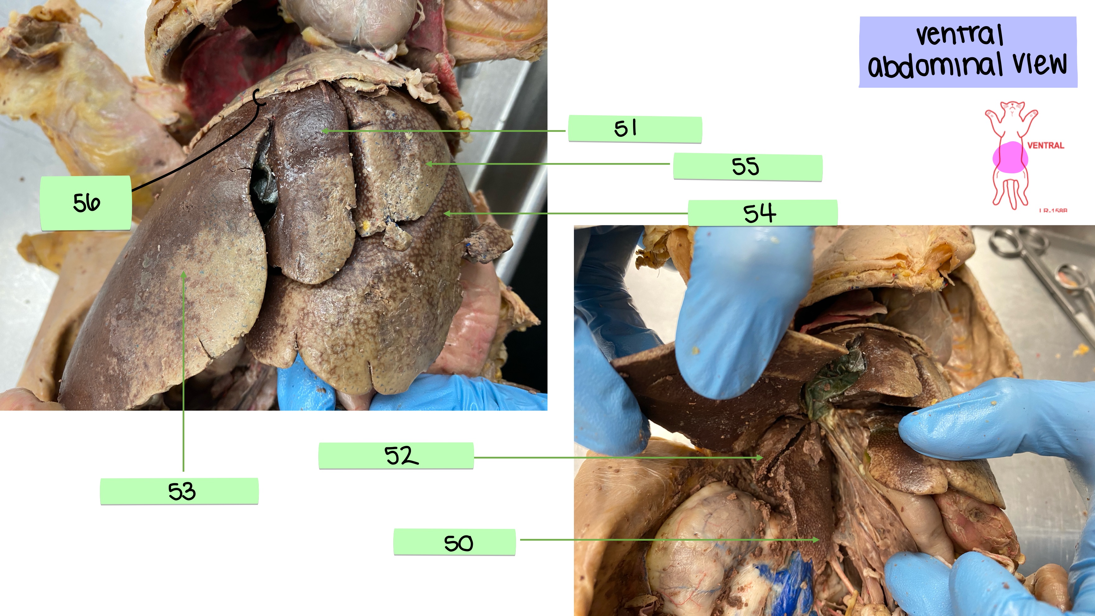 <p>round ligament</p>