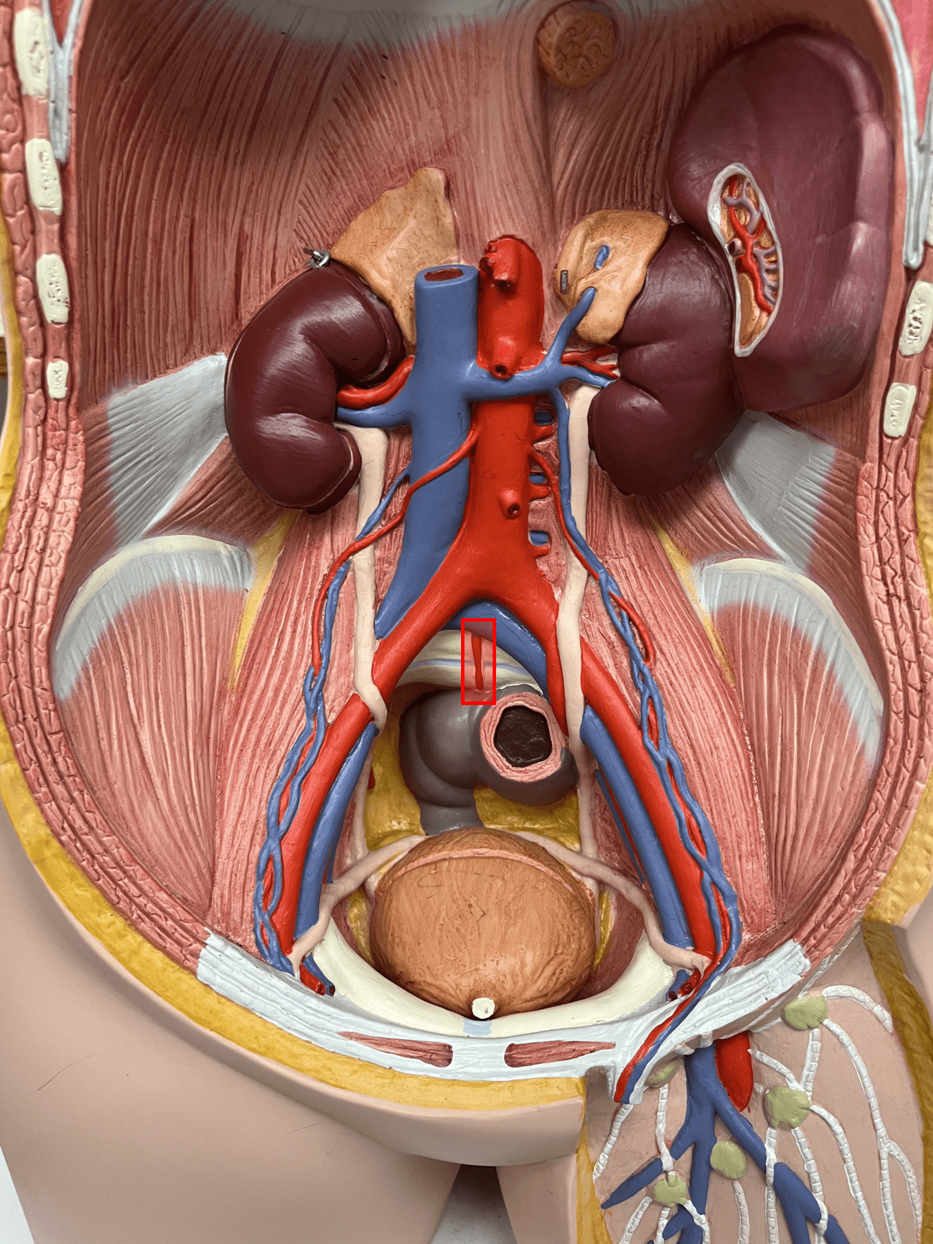<p>• An artery of the abdomen.</p>
<p>• Originates from the abdominal aorta.</p>
<p>• Supplies the sacrum and coccyx.</p>