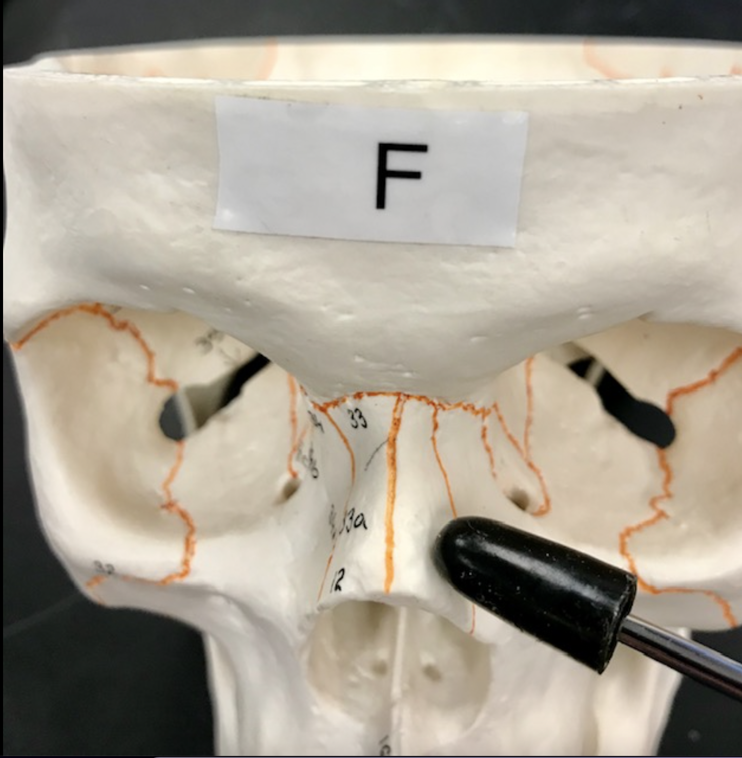 <p>Where is the pointer indicating </p>