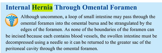 <p>hernia of the intestine</p>