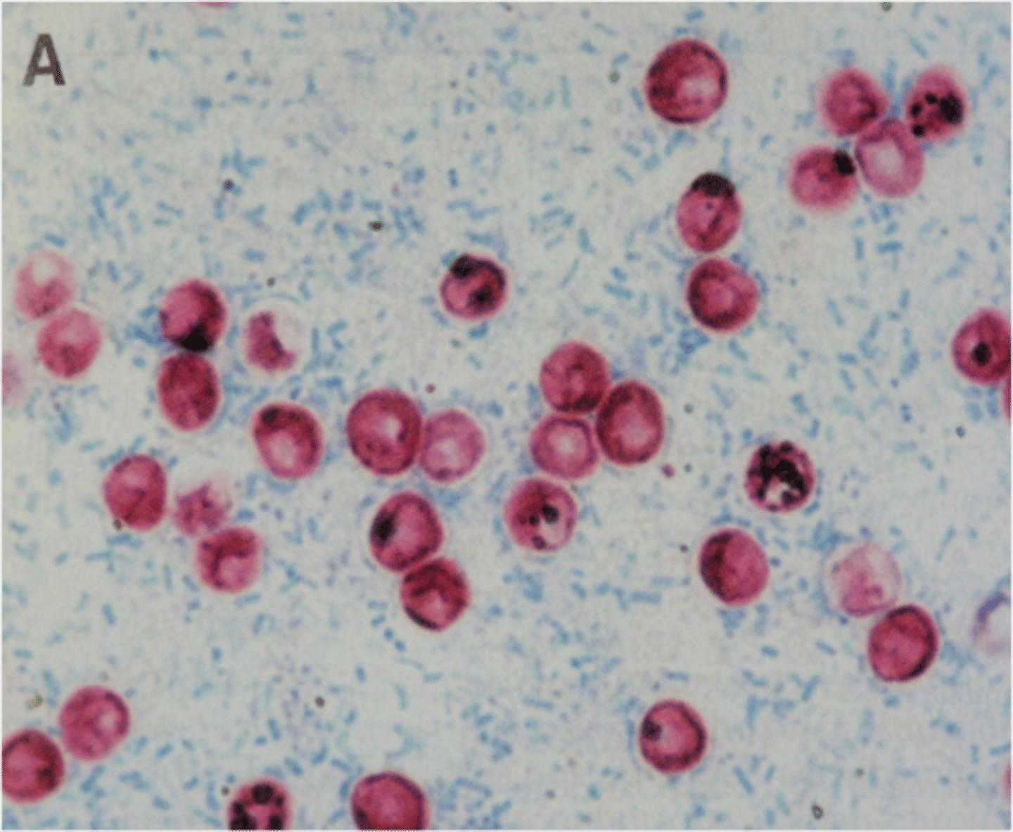 <p>oocysts 4-8 μm, colorless, transparent, difficult to see on fecal slides. Acid-fast staining is used</p>