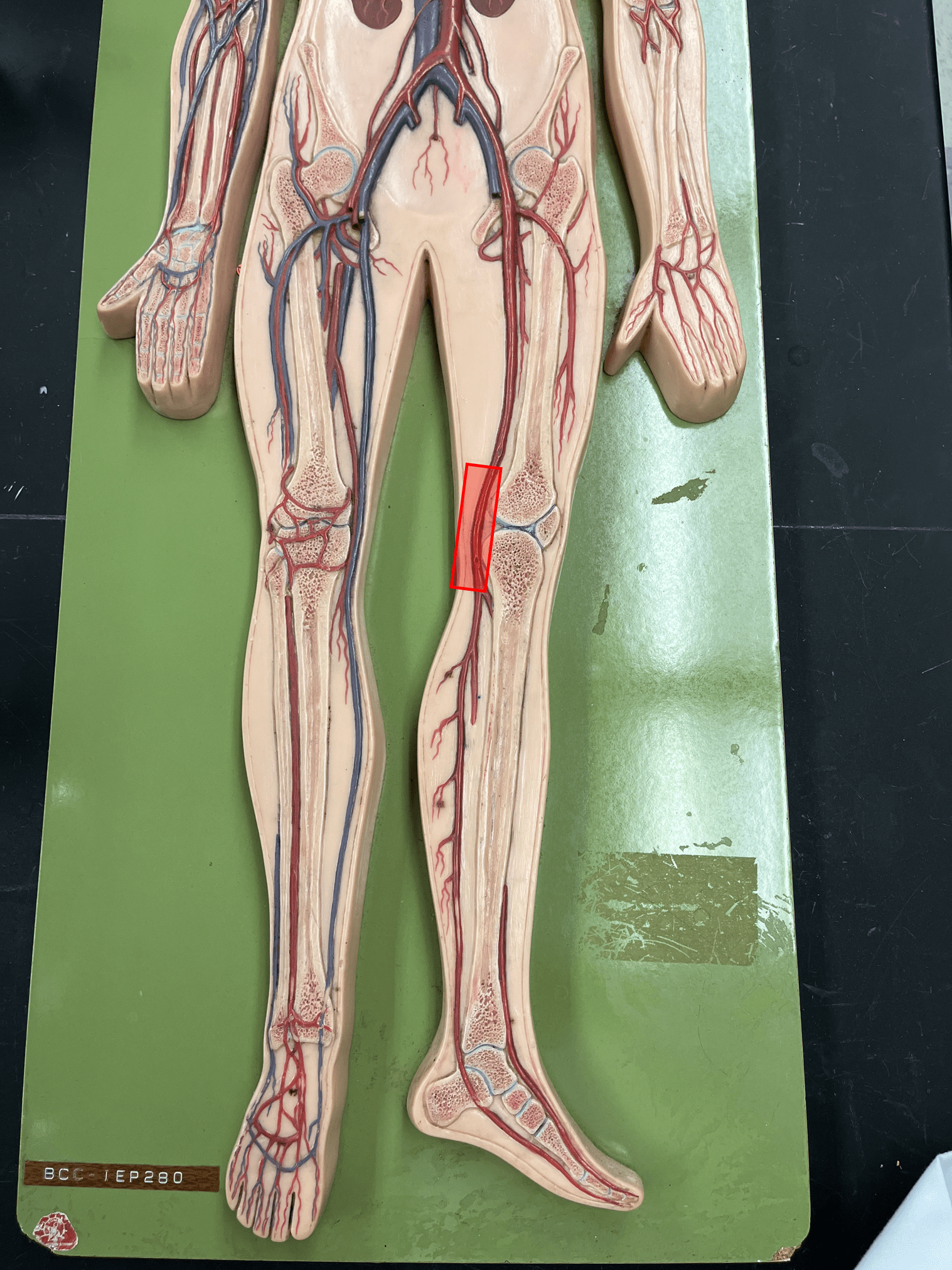 <p>• An artery of the lower limb.</p>
<p>• Originates as the continuation of the femoral artery.</p>
<p>• Supplies the knee.</p>