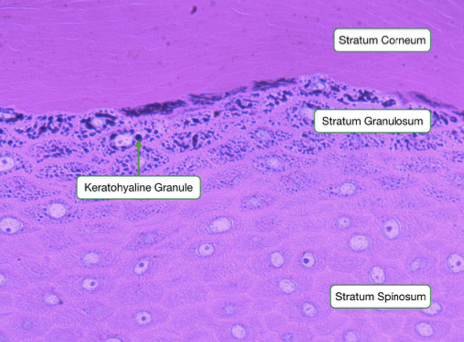 <p>“Granular layer”</p><ul><li><p>Thinner (3-5 layers)</p></li><li><p><mark data-color="yellow">Granules</mark> </p></li><li><p>Keratinocyte death: start to lose their organelles; cell membranes thicken</p></li></ul>