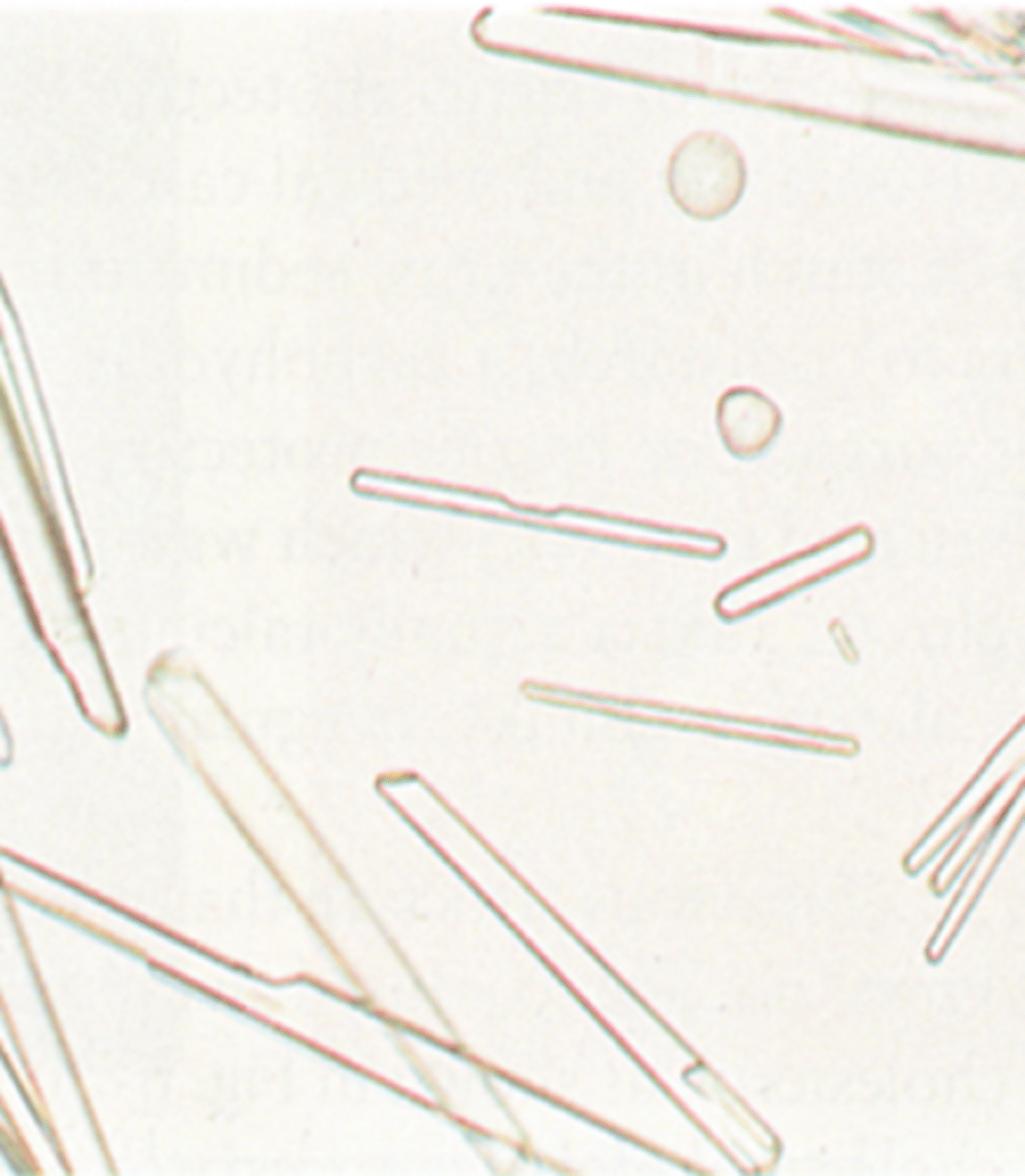 <p>-Very high specific gravity</p>