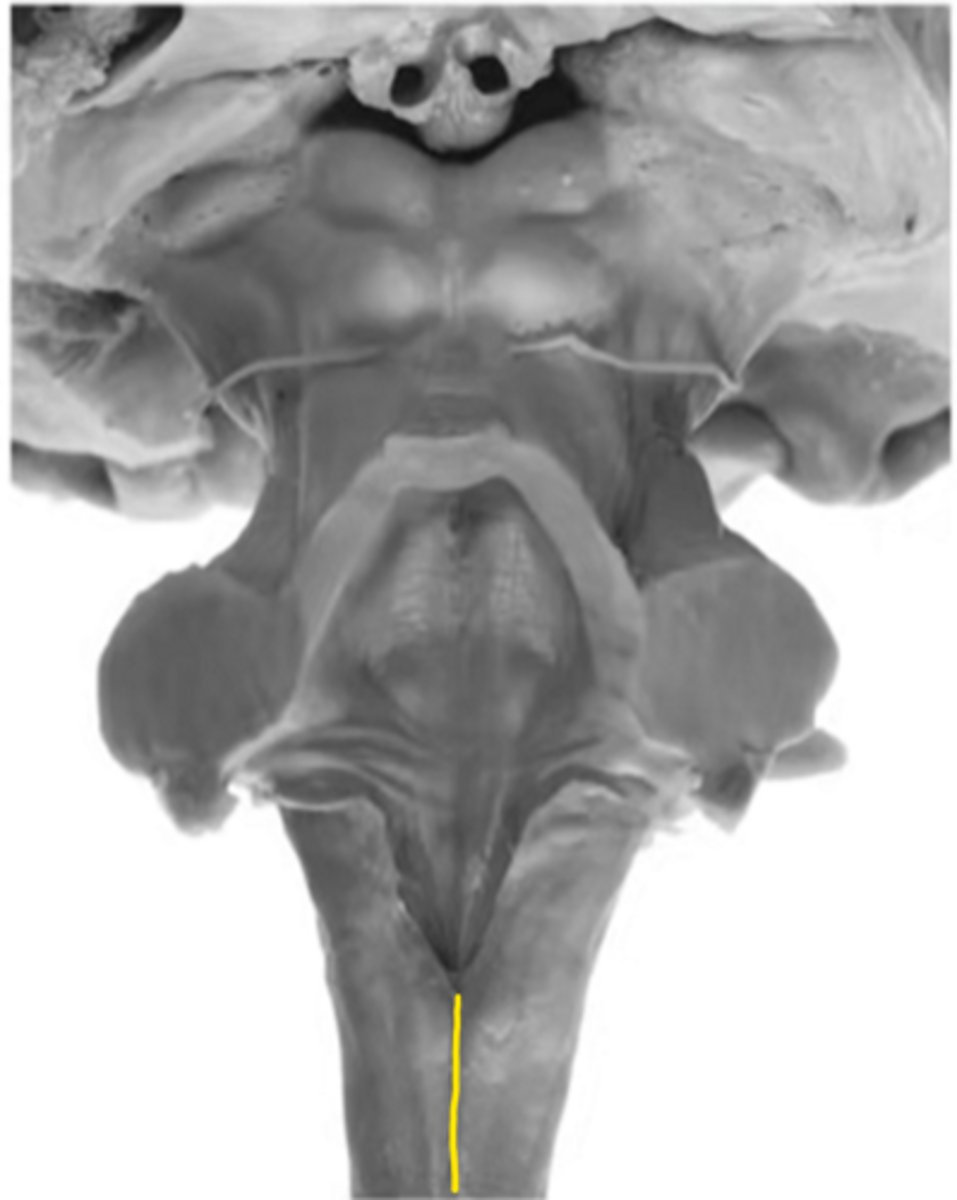 <p>ID the sulcus</p>