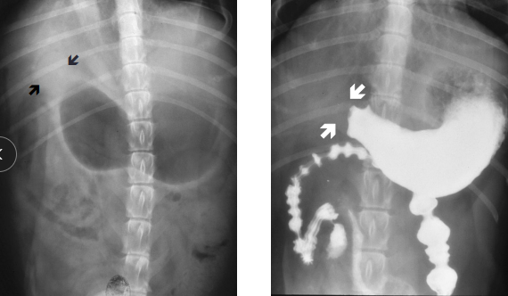 <p><span style="background-color: transparent;"><strong><span>Delayed Gastric Emptying</span></strong></span></p>