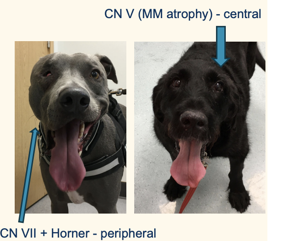 <p>Deficits of other cranial nerves besides CN VII and Horner = central lesion</p>