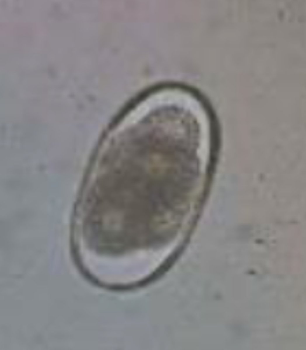 <p>Kidneyworm in pigs</p>