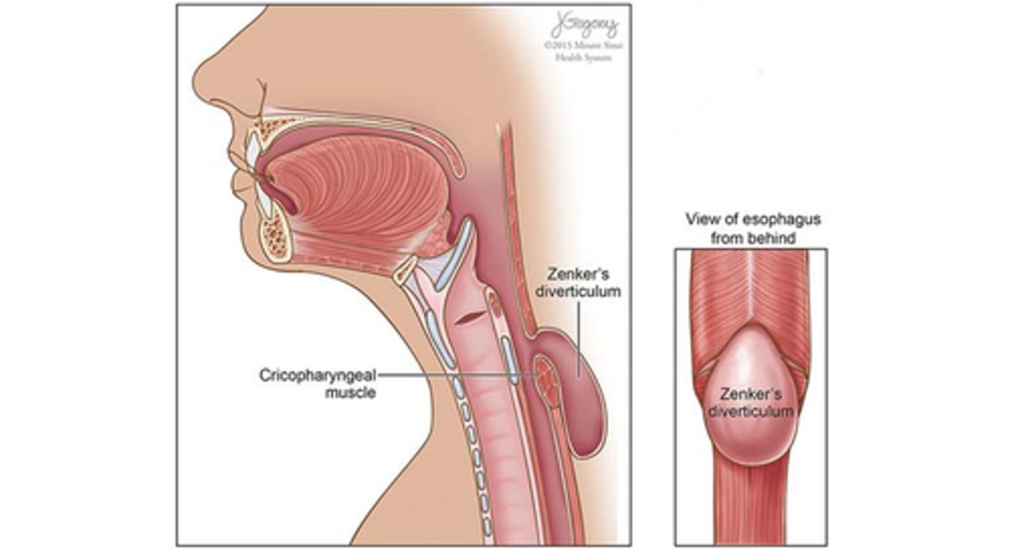 <p>esophagus &amp; cricopharyngeus muscle</p>