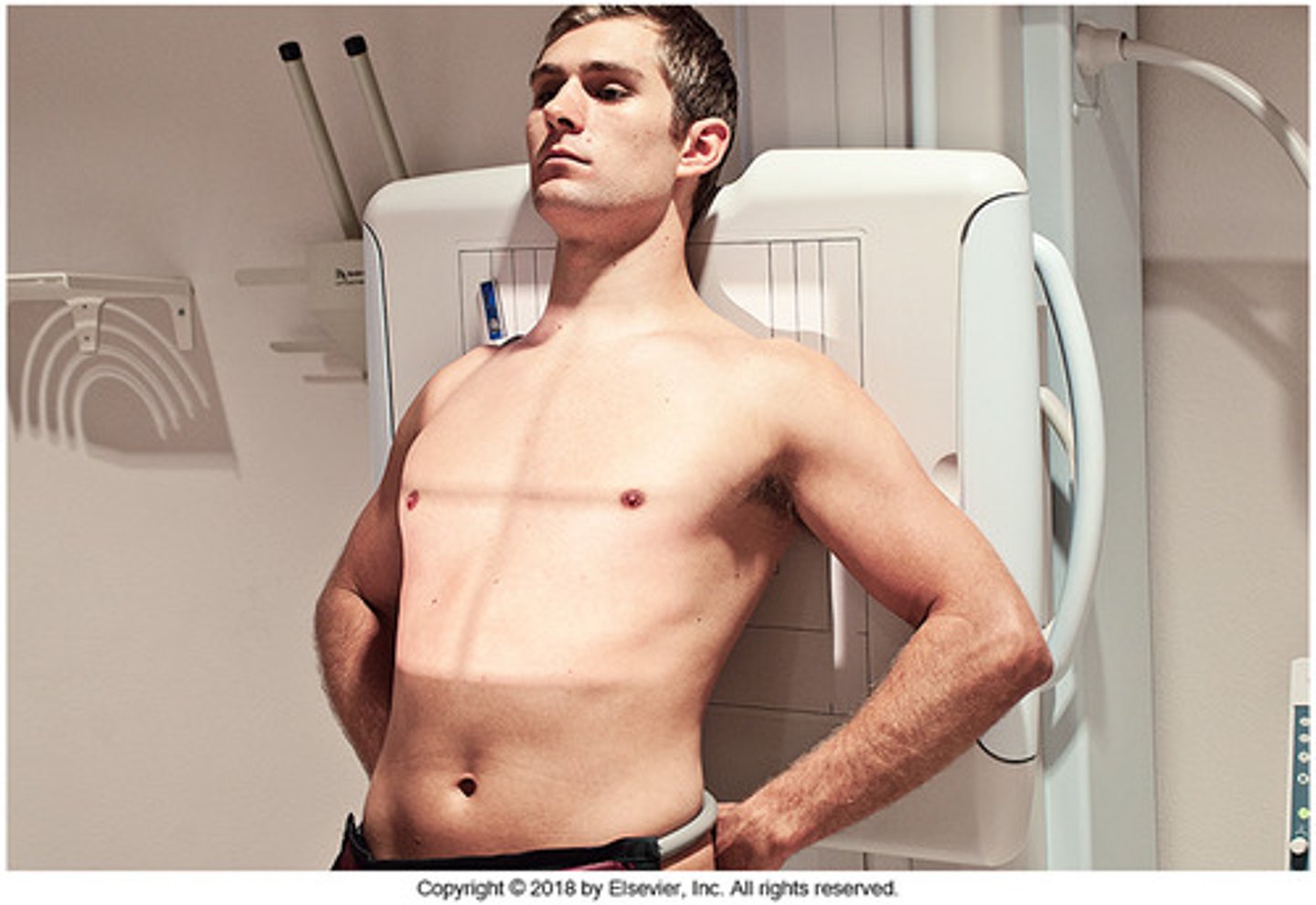 <p>comes from lordosis, a term that denotes curvature of the cervical and lumbar spine.</p>