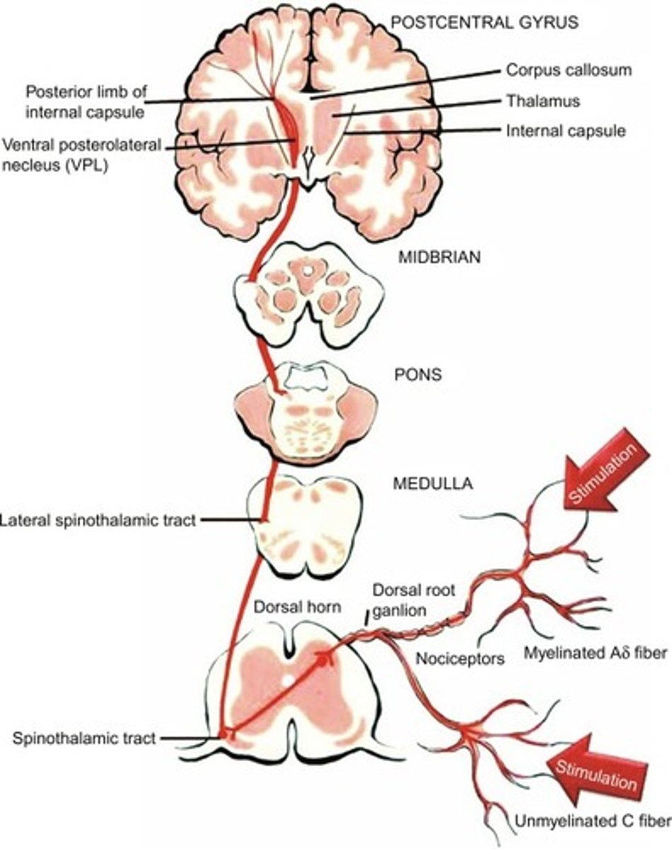 <p>1. Sensory Receptors → Detect pain and temperature signals.</p><p>2. Spinal Cord → Signals enter the spinal cord, decussate (cross) at the entry level.</p><p>3. Ascend → Travel up the spinothalamic tract to the thalamus.</p><p>4. Thalamus → Relays information to the primary somatosensory cortex for processing.</p>