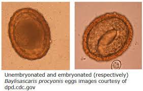 <p>A nematode parasite causing Neurologic Larval Migrans, common in raccoons, transmitted via ingestion of infective eggs, leading to neurologic signs.</p>