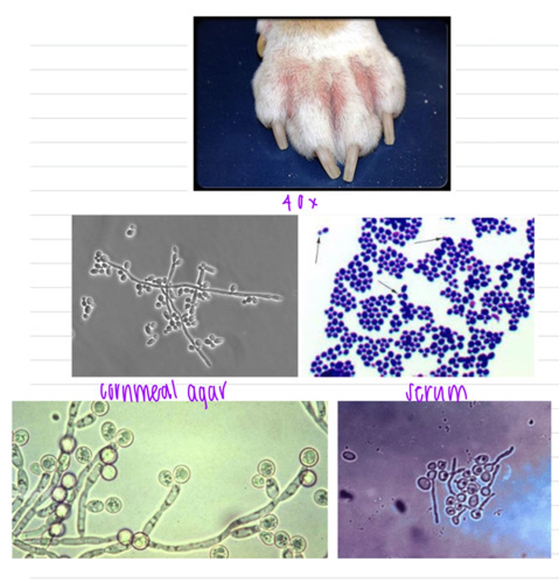 <p>this dog has lesions between his toes. we take a sample, isolate it in cornmeal agar and serum, and look at it under a microscope, where we see these results.</p><p>what is the diagnosis?</p>