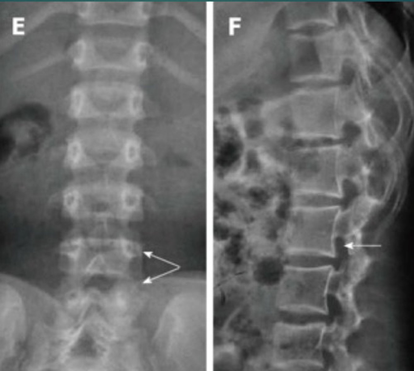 <p>What abnormality is this?</p>