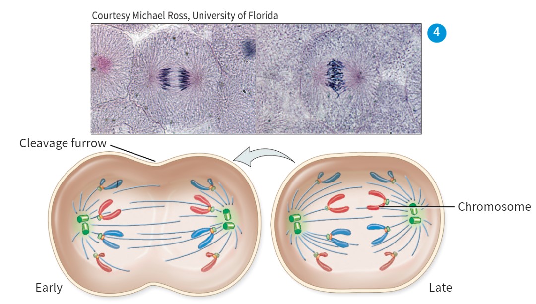<p>Chromosomes are separated into sister chromatids </p><p>-spindles are faded/not there</p><p>-chromosomes are dark and being pulled apart from the middle</p><p></p>