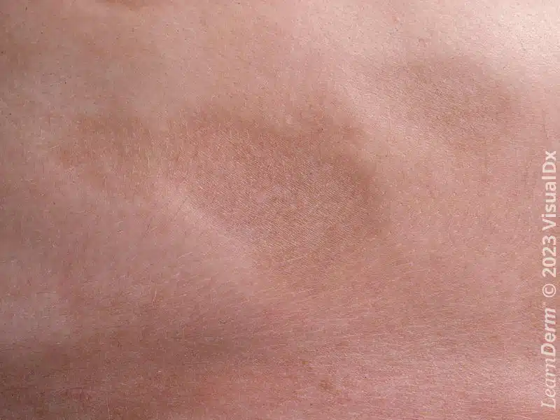 <p></p>