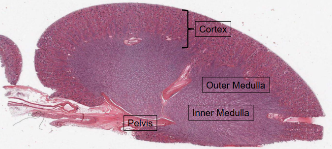 <ul><li><p>Boundary between the Cortex (contains the renal corpuscles) and the medulla is very clearly delineated. </p></li><li><p>Medulla is further divied into: </p></li></ul><ol><li><p>Outer medulla (adjacent to the cortex)</p></li><li><p>Innder medulla (adjacent to the pelvis)</p></li></ol><p></p>