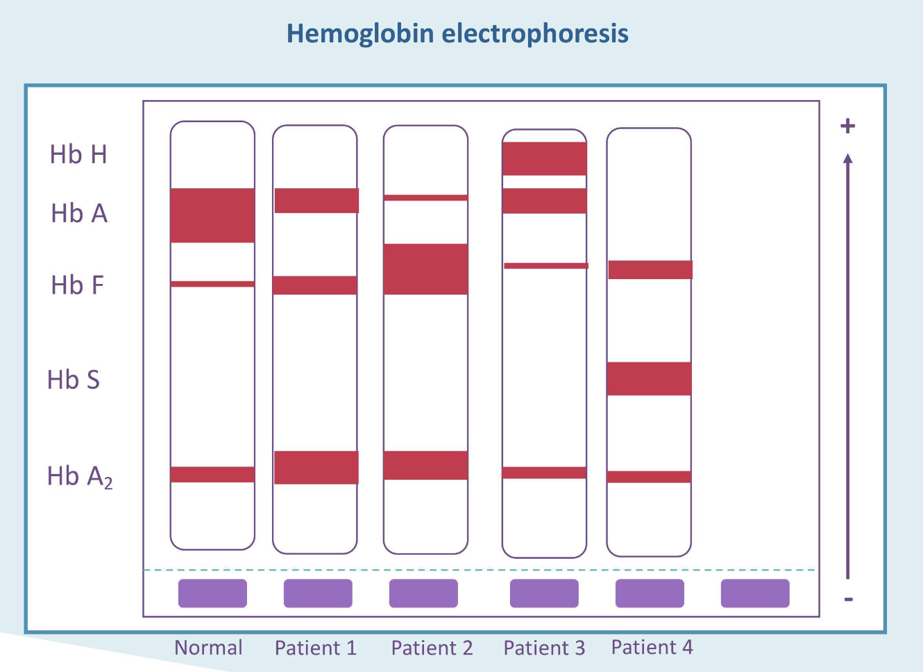 <p>What is the most likely diagnosis for patient 1?</p>
