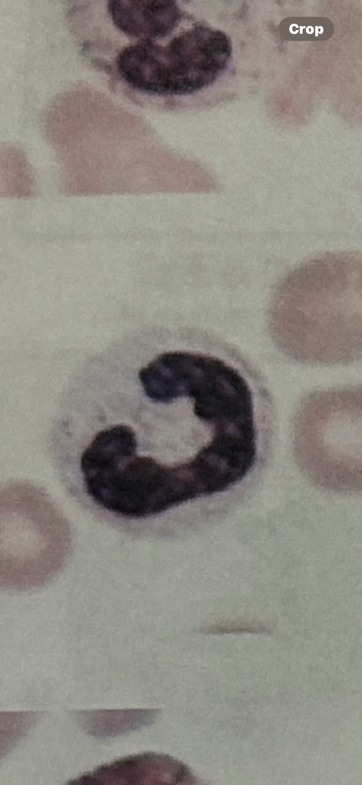 <p>WBC</p>