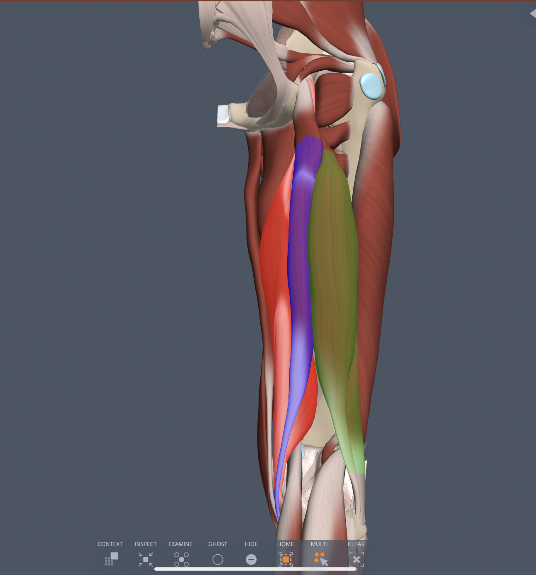 semitendinosus (posterior thigh) origin
