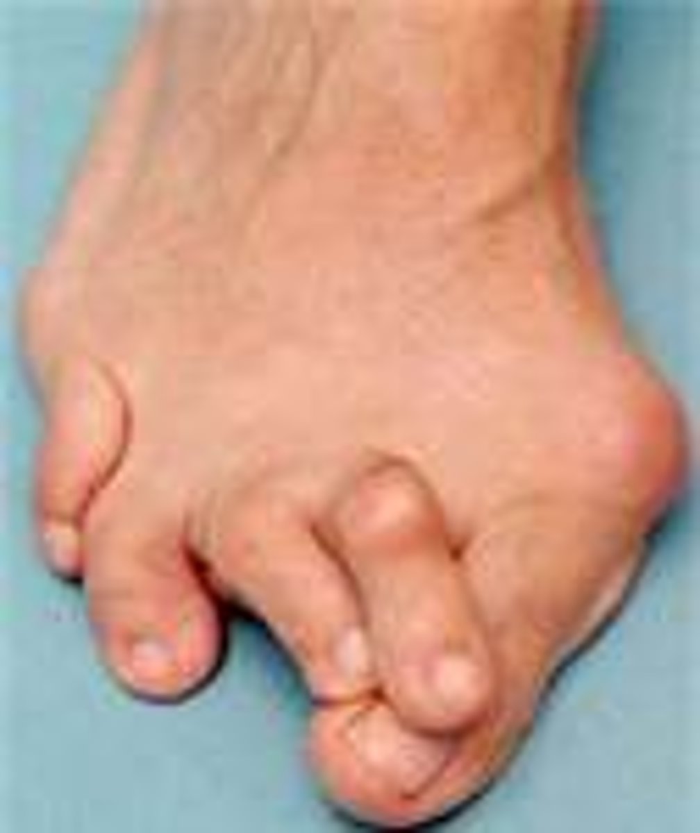 <p>When a combination the stars, planets and moons are in an unusual position - usually a sign of something good or bad</p>