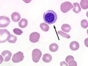 <ul><li><p>immature cells in anemia</p><ul><li><p>early release of RBC</p></li></ul></li><li><p>can be seen in nonanemic animals</p></li><li><p>normal in nonmammals </p></li></ul><p></p>
