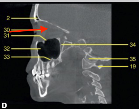 <p>identify the structure </p>