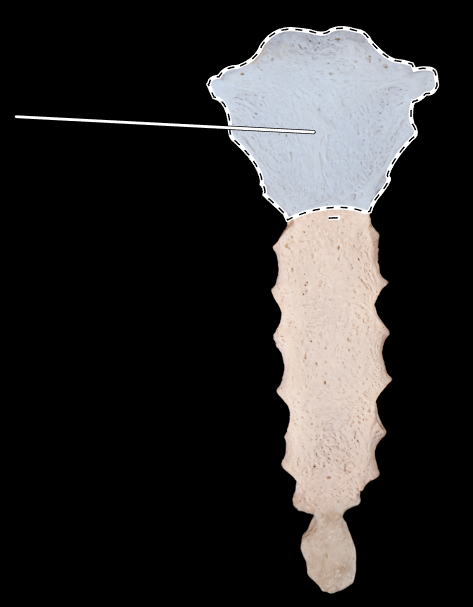 <p>What is the highlighted section called?</p><p>(Sternum, anterior view).</p>