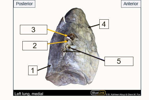 <p>Label the structures indicated by the arrows </p>