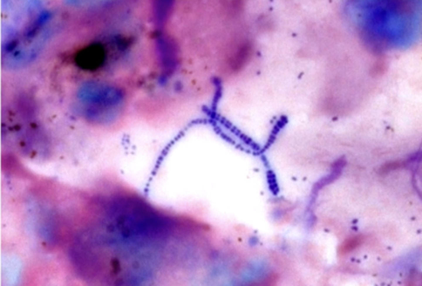 <p>Dermatophilus congolensis</p>