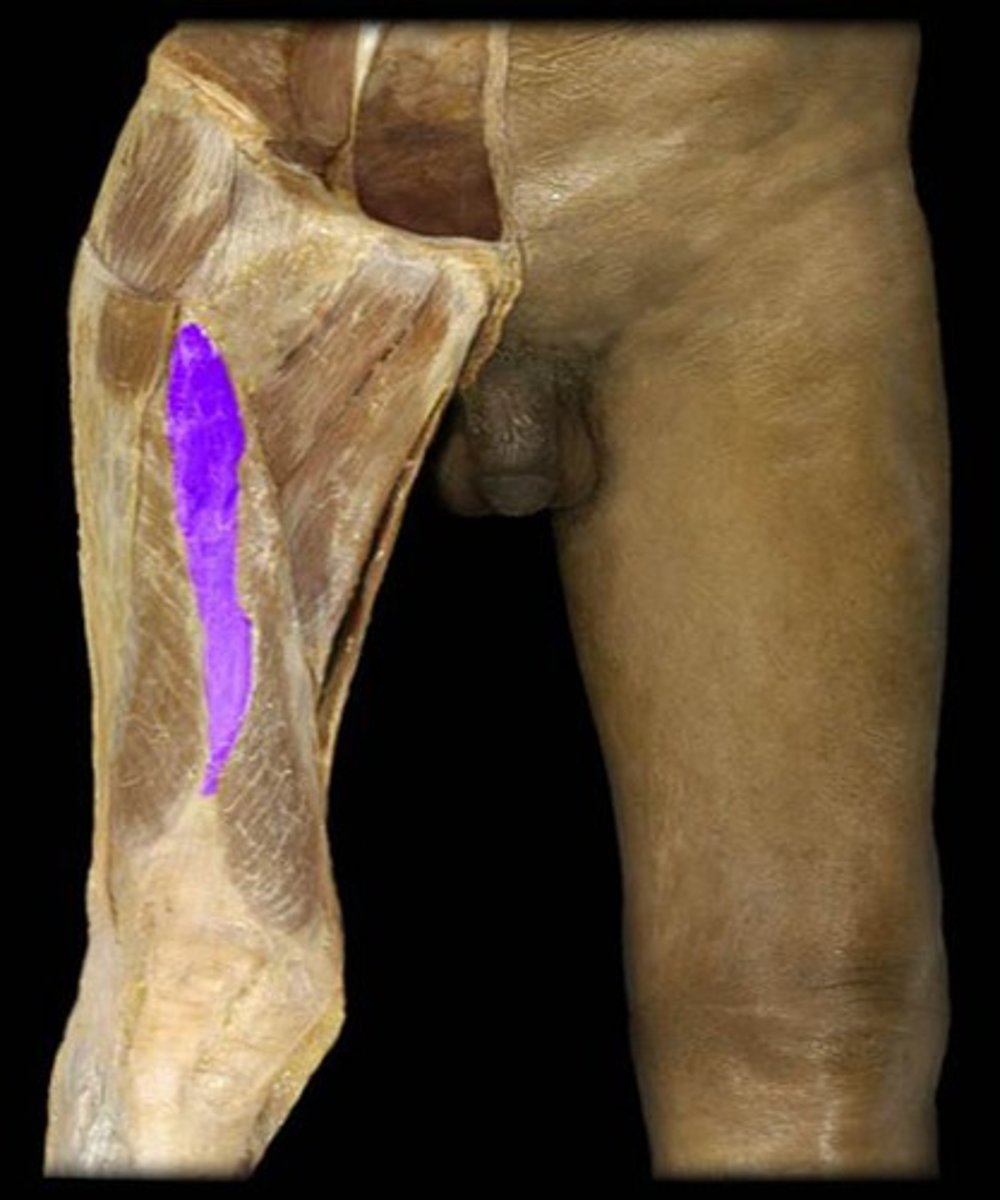 <p>What is the name of this muscle, highlighted in purple?</p>