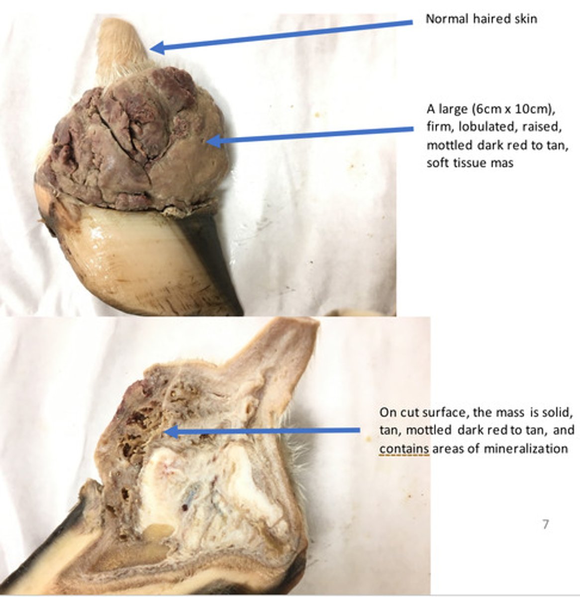 <p>What is granulation tissue?</p>