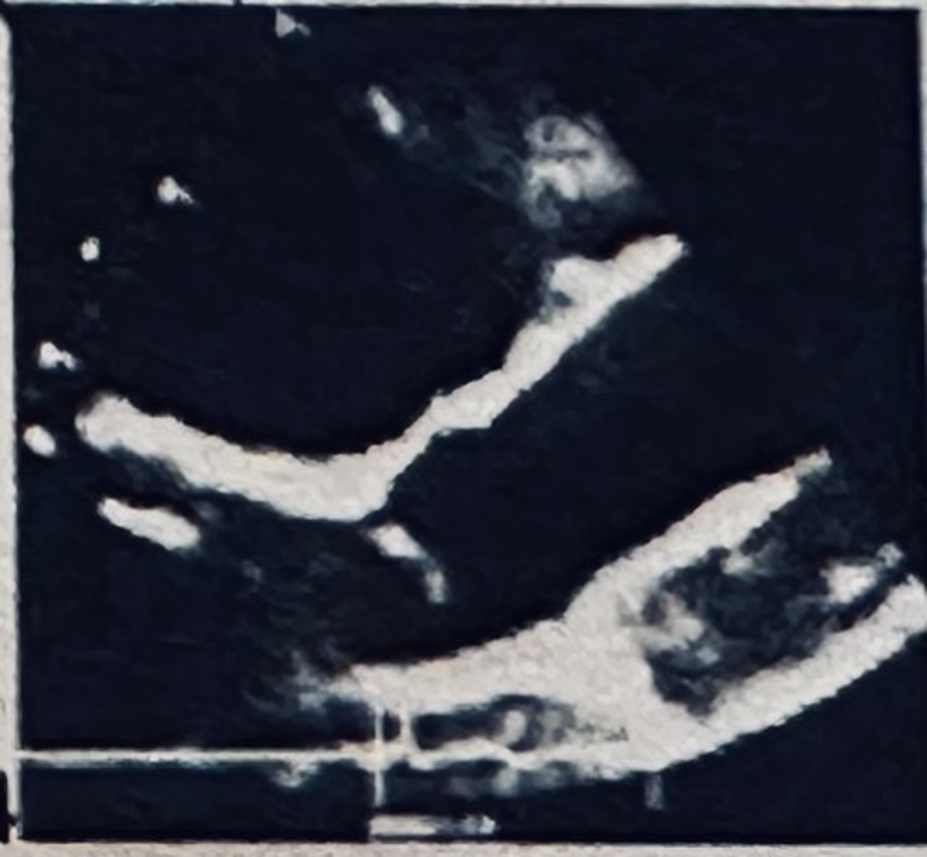 <p></p>