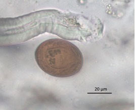 <p><em>Platynosomum fastosum</em></p><ul><li><p>Brown, operculated eggs</p></li></ul><p></p>